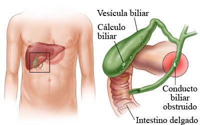 vesicula biliar1